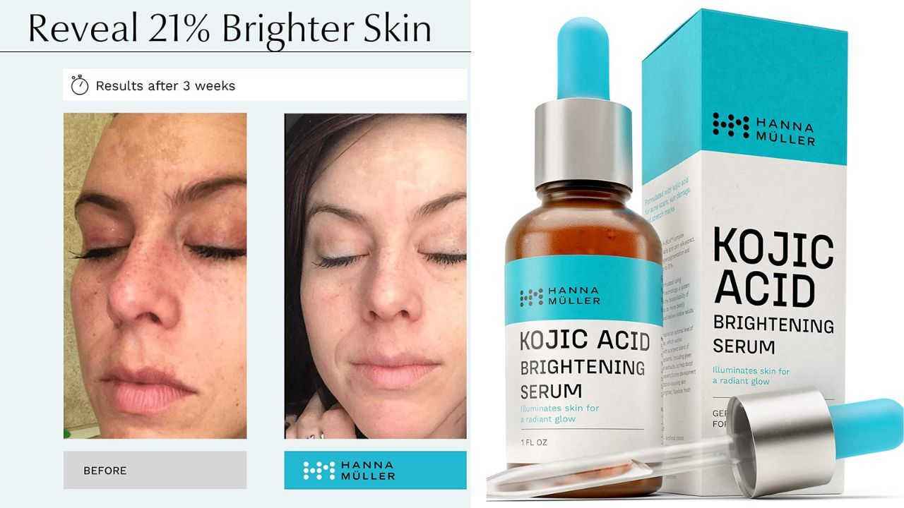 Say "Goodbye" To Lackluster Skin And "Hello" To A Radiant, Youthful Glow!