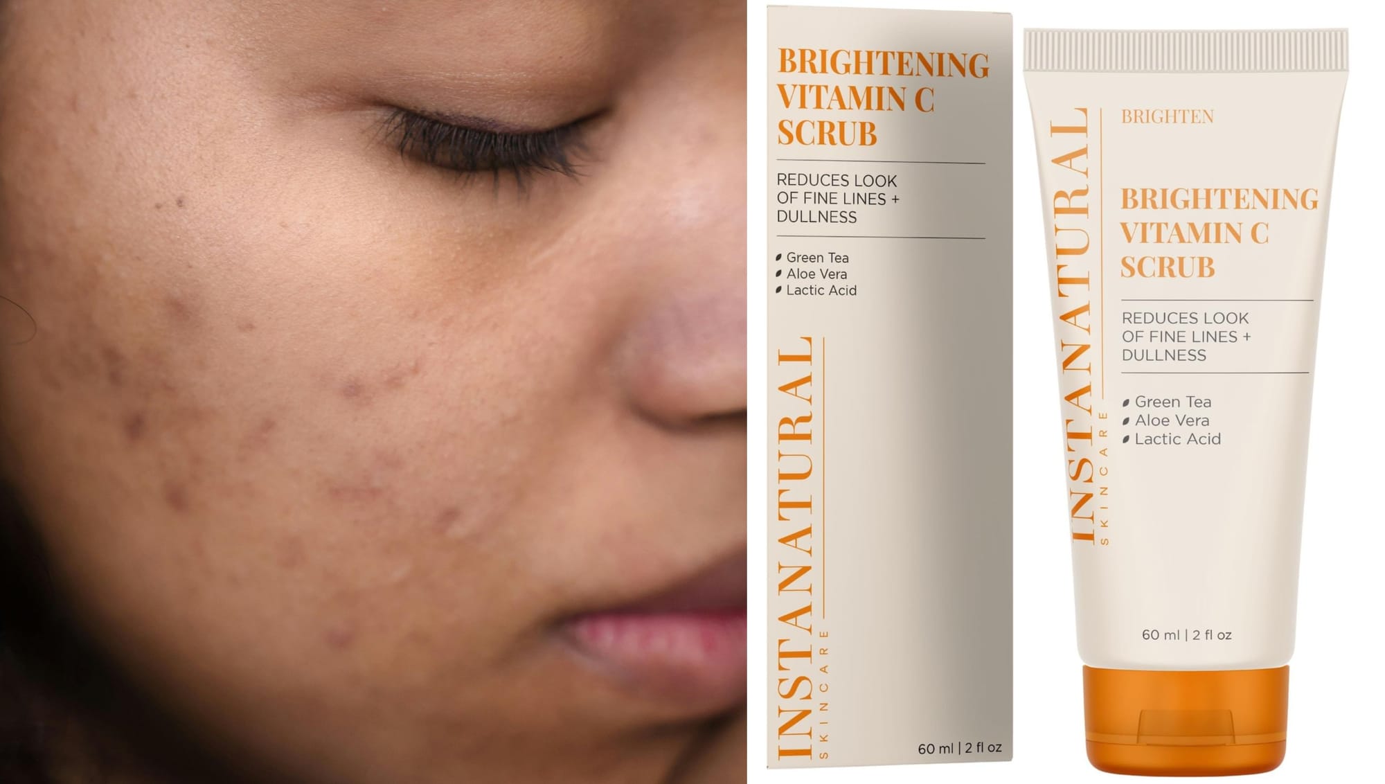 Say goodbye to dark spots and dullness—Vitamin C is your key to a brighter, smoother complexion!