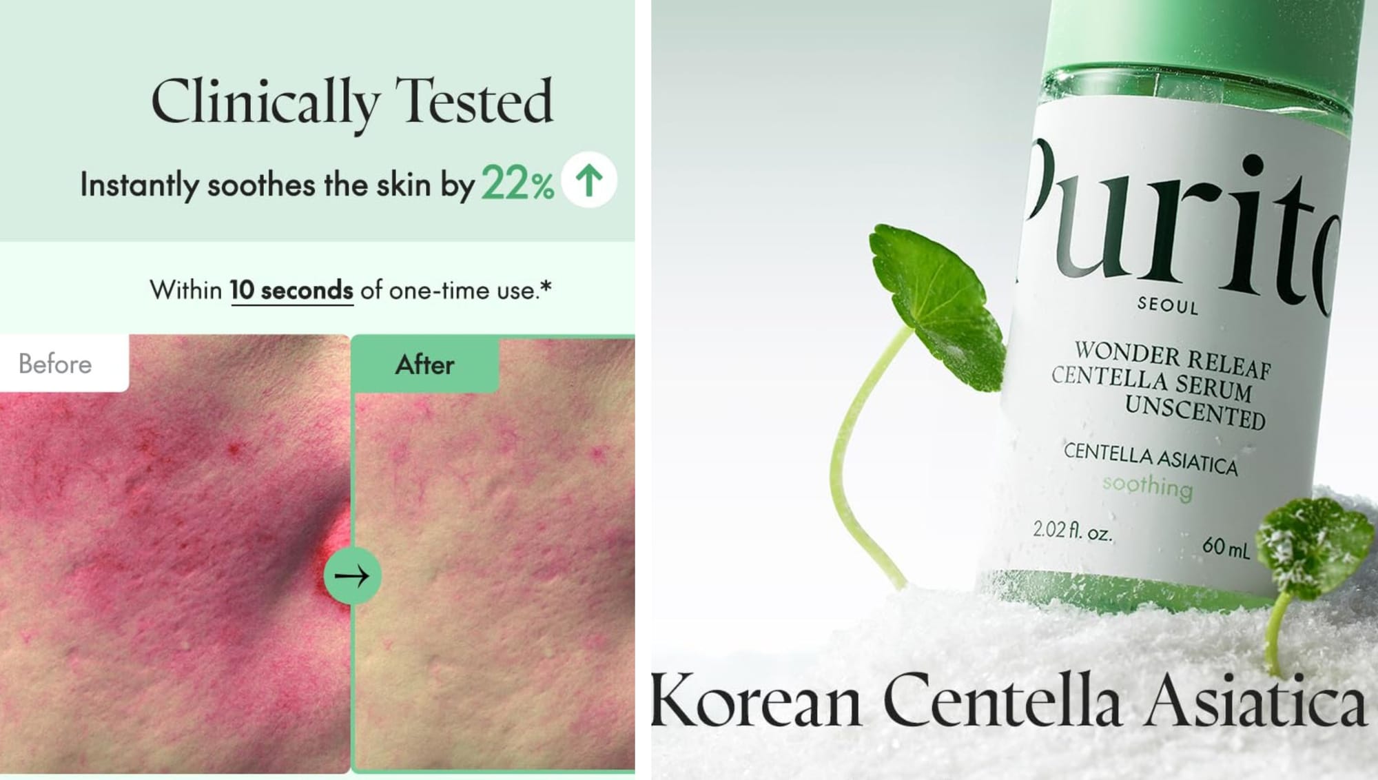 Discovering Centella Serum: Your Skin's New Best Friend