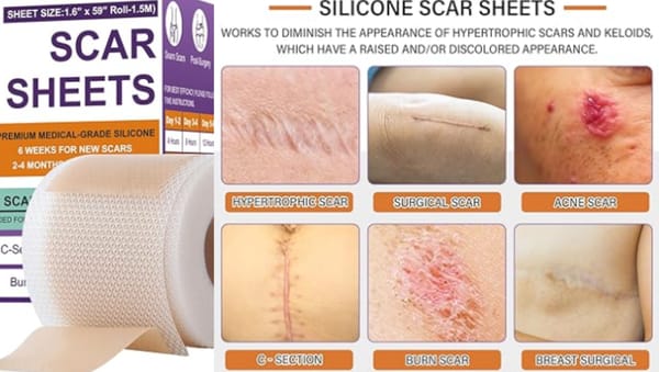 Fade scars faster with medical-grade scar tape.